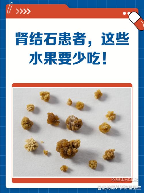 肾结石减肥吃什么水果最好