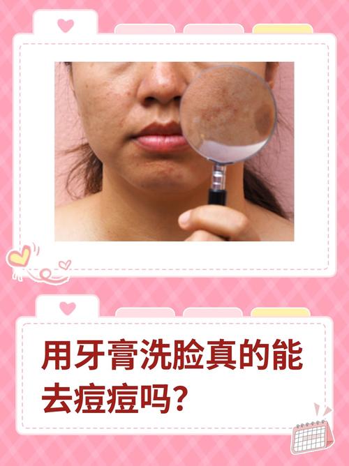 长痘痘不用洗面奶好吗