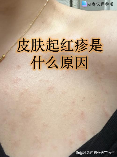 10度护肤品会过敏吗