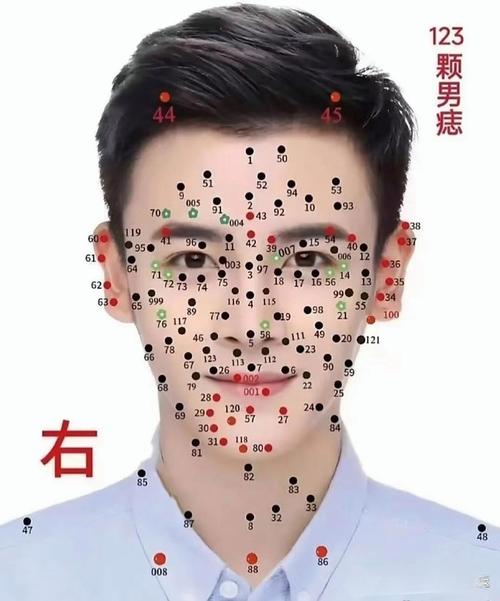 为什么脸上长黑痣