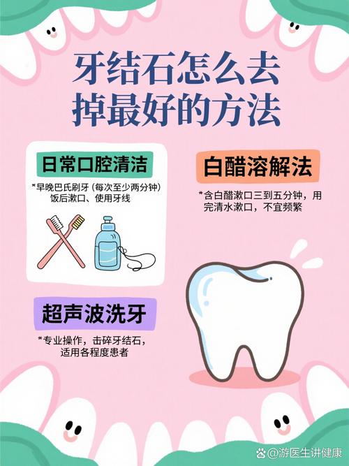 牙结石用什么去除