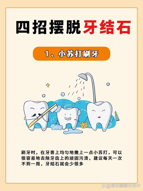 牙结石用什么去除