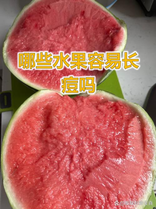 起痘吃什么水果