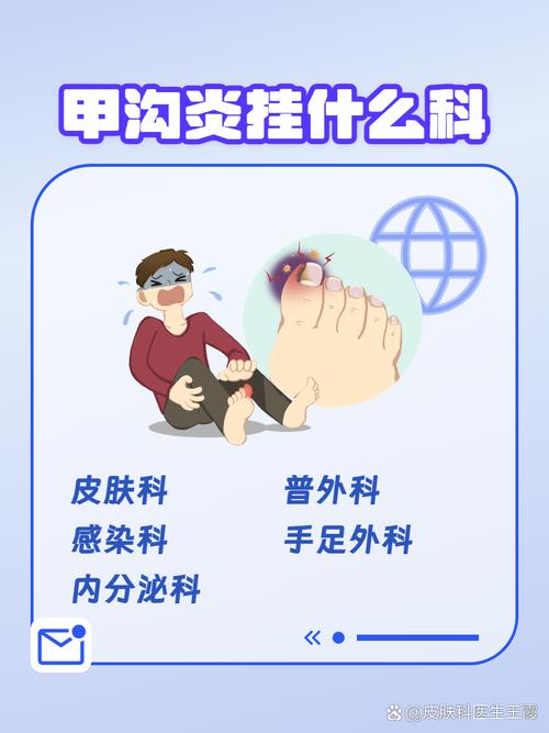 医院甲沟炎挂什么科