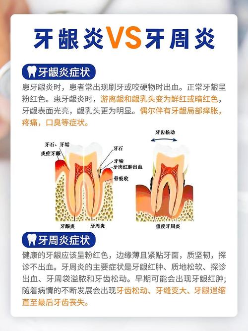 牙齿为什么会发炎