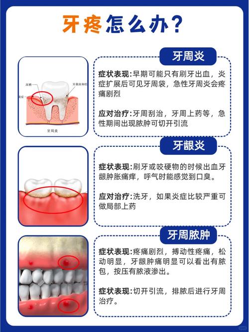 牙齿为什么会发炎