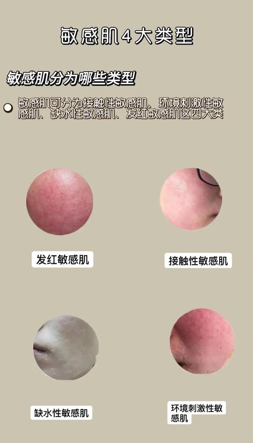 什么是敏感皮肤