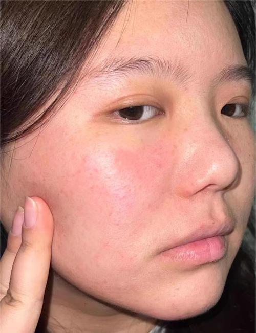 护肤品涂在脸上感觉油