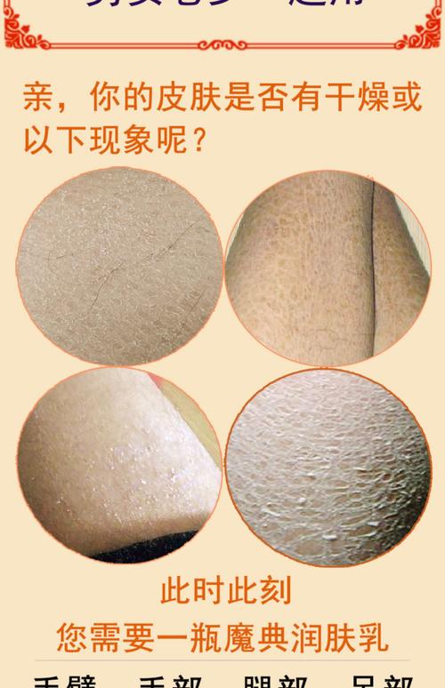 身体干燥擦什么护肤品