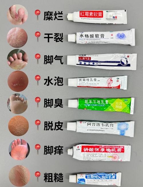 脚癣用什么泡脚