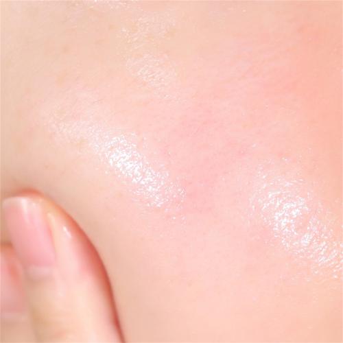 补水护肤品感觉油油的