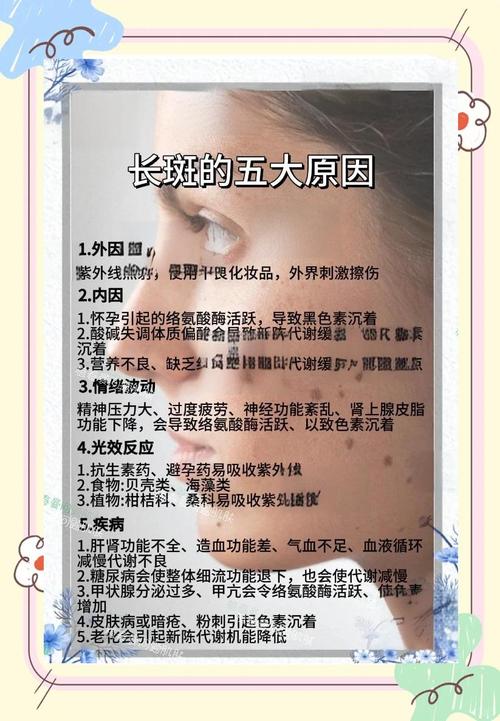 为什么容易长斑