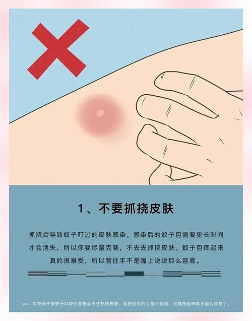 什么办法消肿快