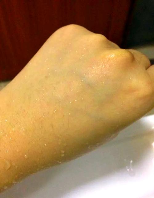 伊思洗面奶会长痘痘吗