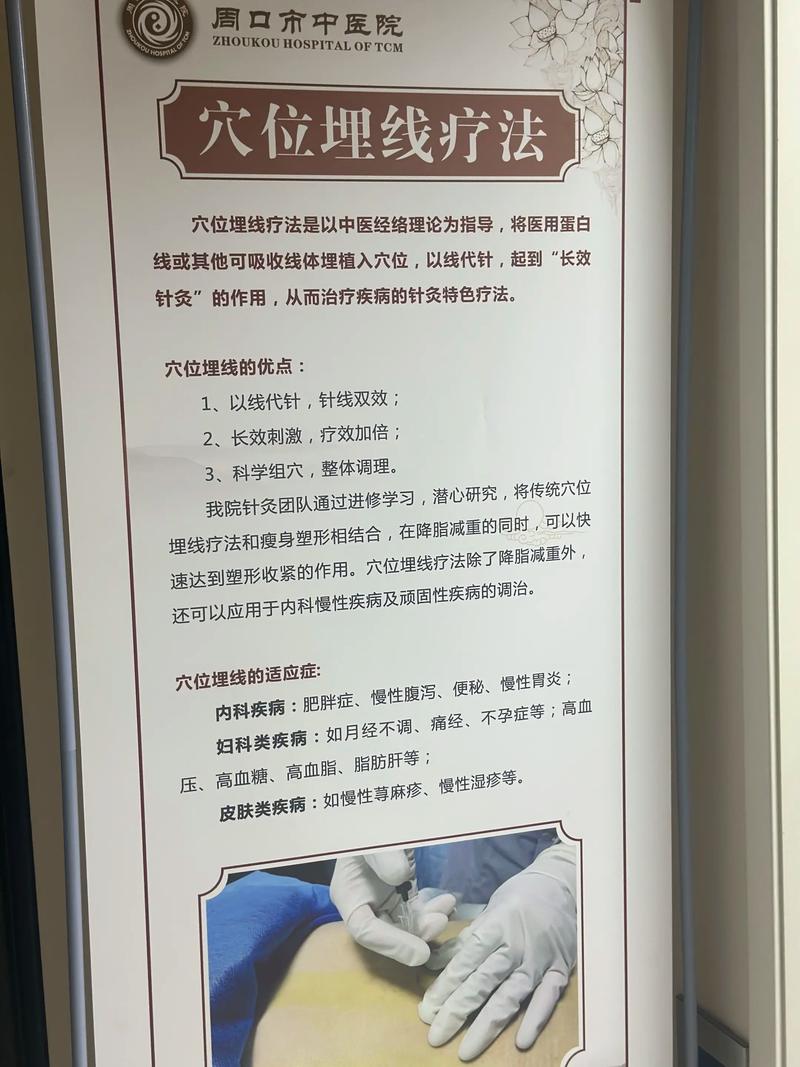 杭州埋线减肥挂什么科
