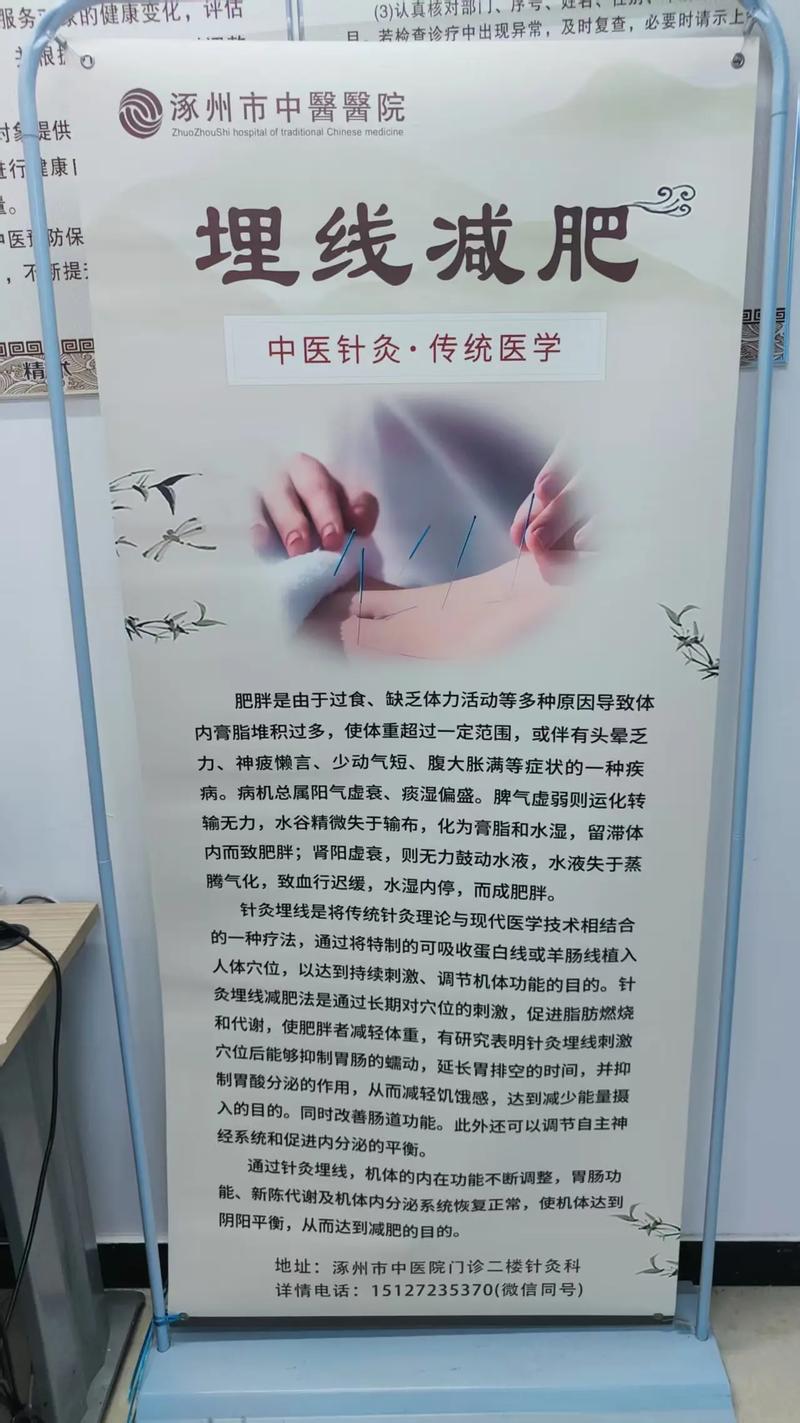 杭州埋线减肥挂什么科