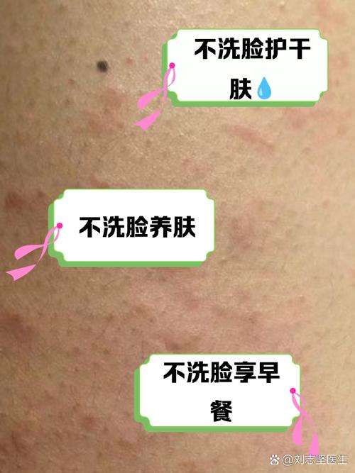 早上应不应该用洗面奶