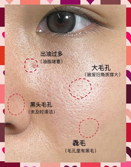 脸上油是什么原因