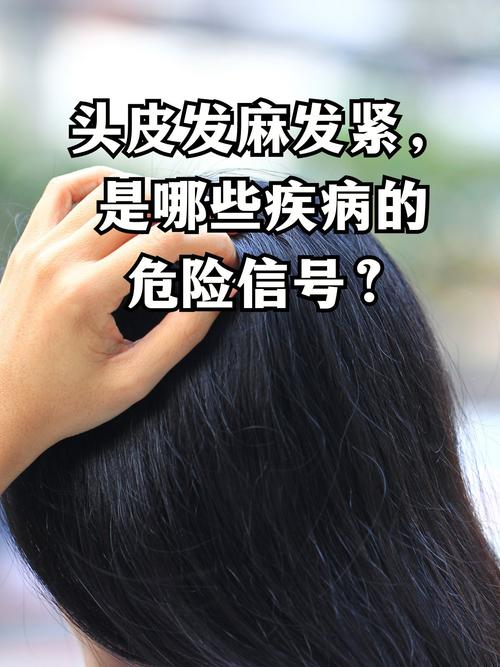 头皮麻是什么原因