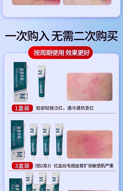 脸过敏后用什么护肤品