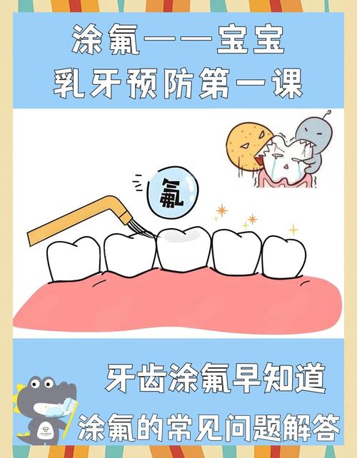 牙齿涂氟是什么