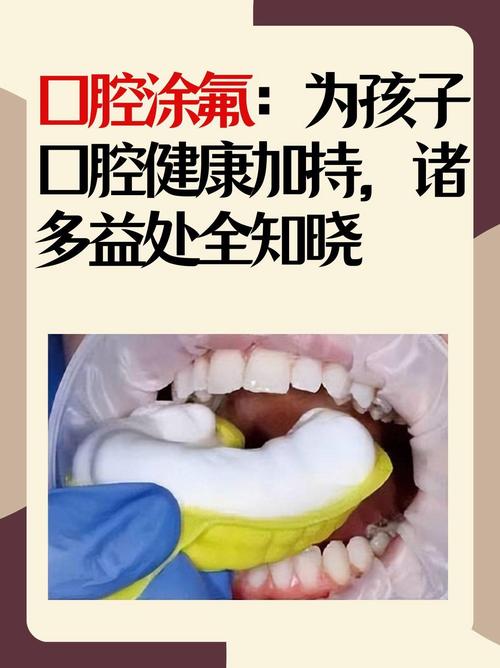 牙齿涂氟是什么
