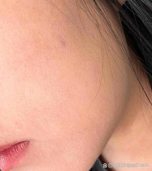 洗面奶洗后脸上有白色