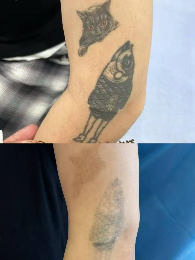 为什么纹身洗不掉