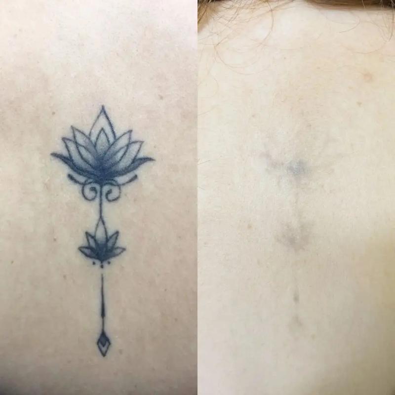 为什么纹身洗不掉