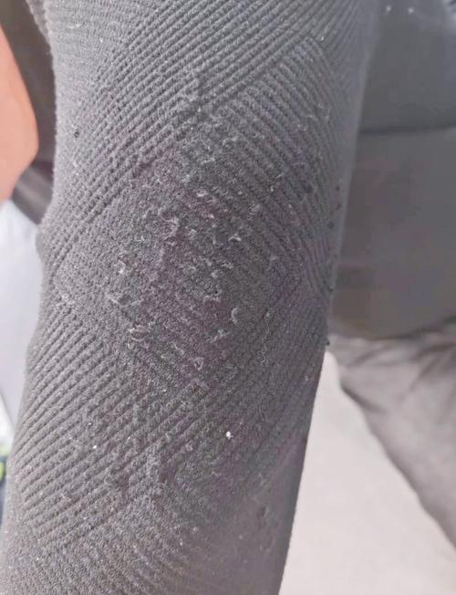 毛衣为什么会起球