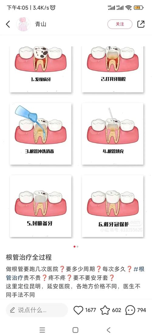 补牙是什么原理