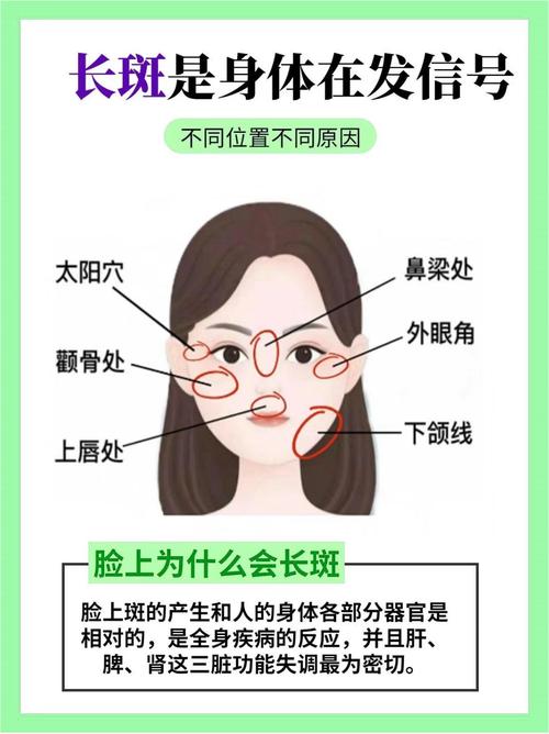 为什么脸上长黑斑