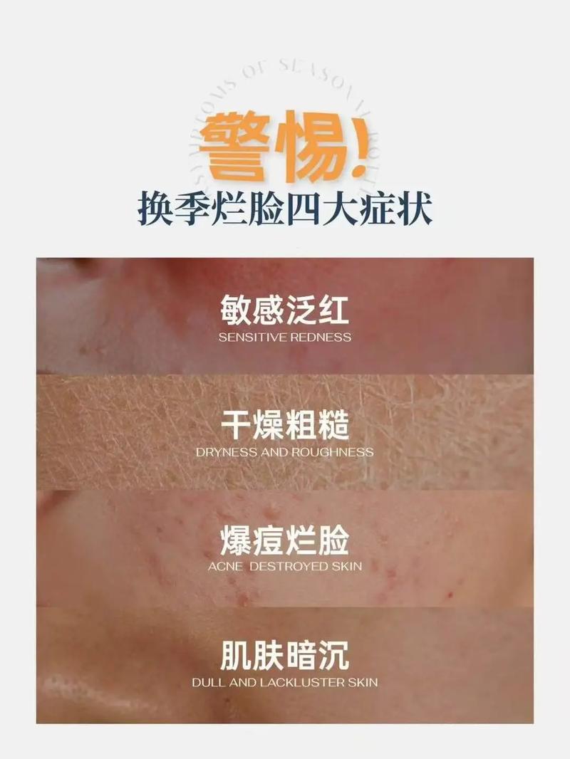 敏感皮肤不能用护肤品