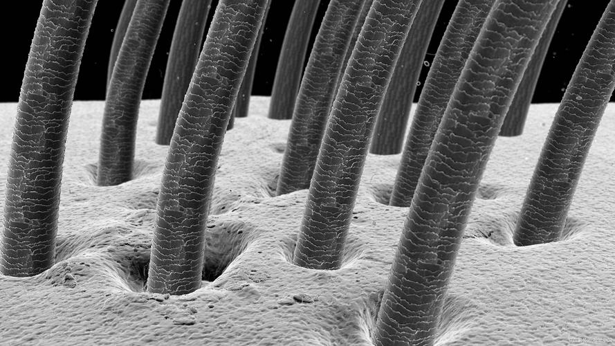 头发是什么物质