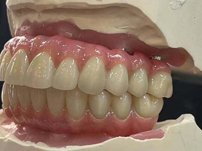 假牙什么样的好