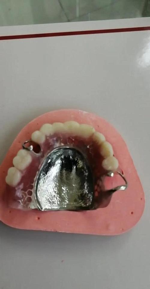 假牙什么样的好