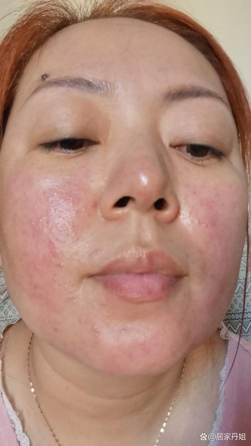 花印备长炭洗面奶过敏