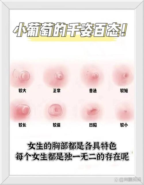 乳头内陷什么样