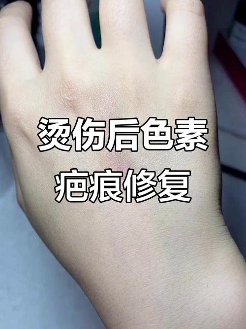 疤痕是什么颜色的