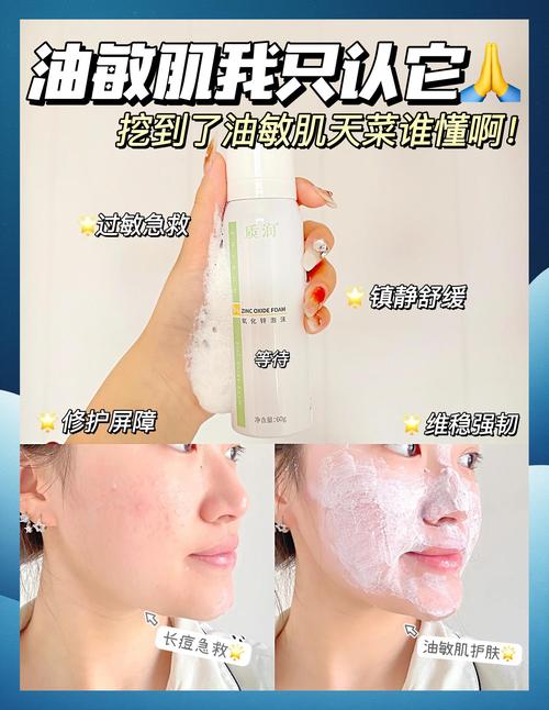 额头长痘能用洗面奶吗