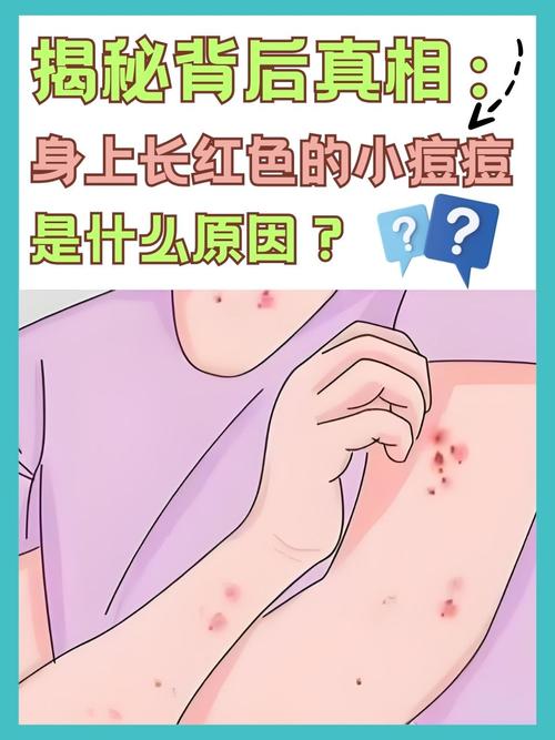 为什么会突然长痘