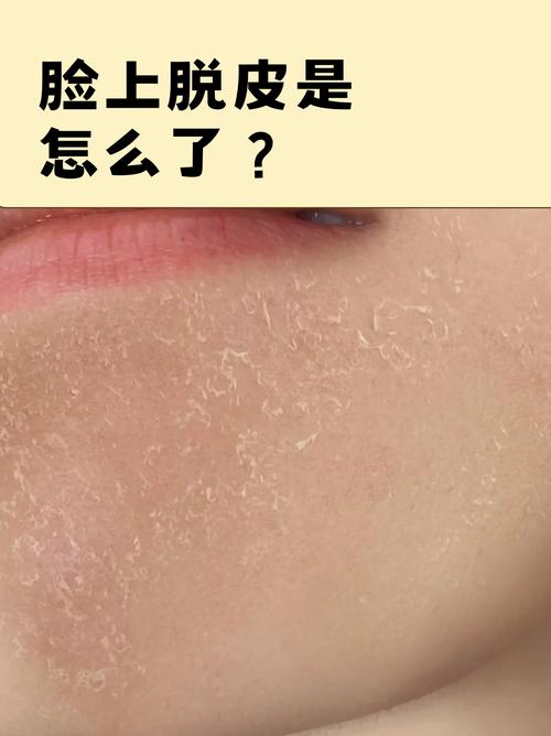 脸上起皮能用洗面奶吗