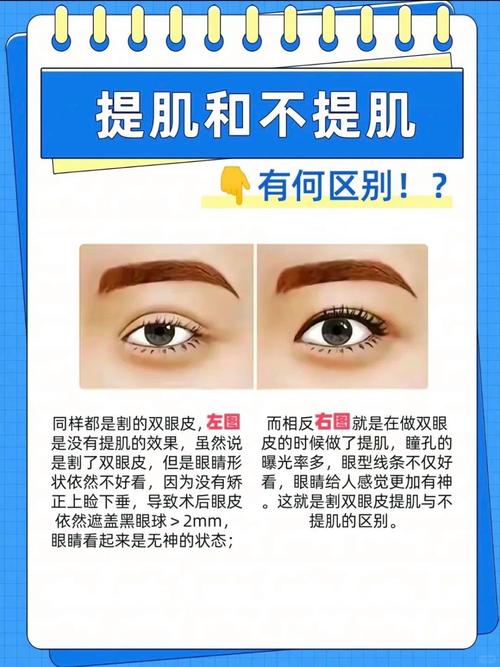 为什么要做双眼皮