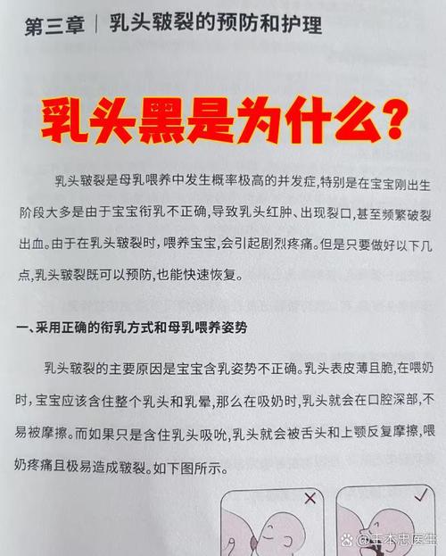 乳头发黑什么原因