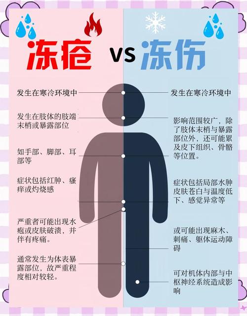 为什么会生冻疮