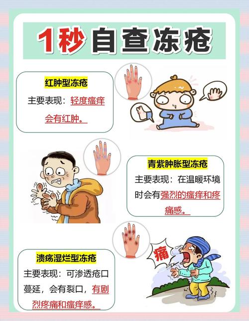 为什么会生冻疮