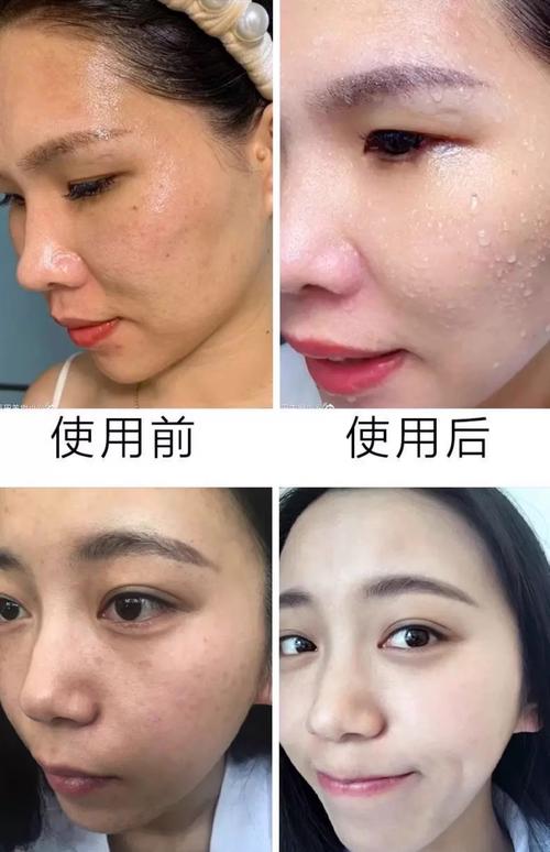 什么面膜可以祛斑