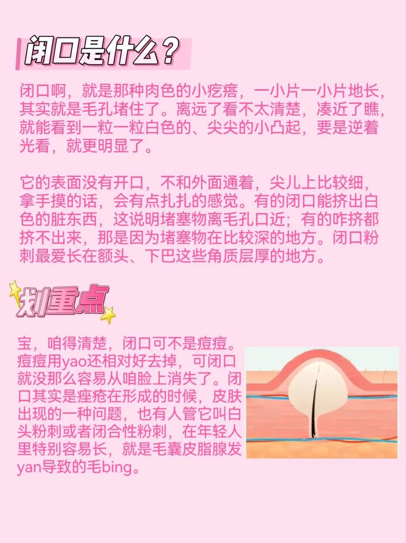 什么护肤品会导致闭口