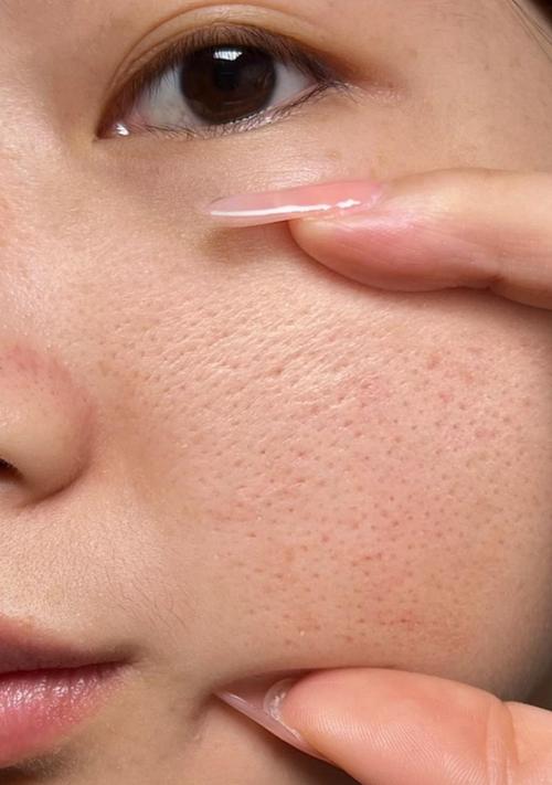 脸毛孔大用什么护肤品