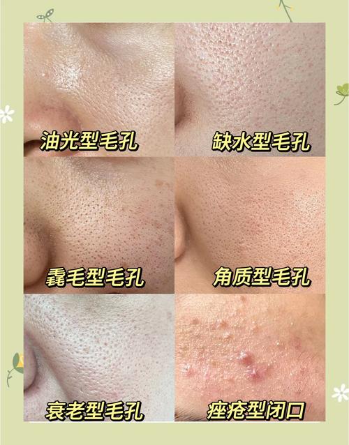 脸毛孔大用什么护肤品